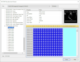 Sante DICOM Editor