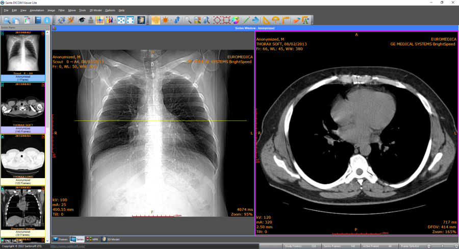 Sante DICOM Viewer CD/DVD
