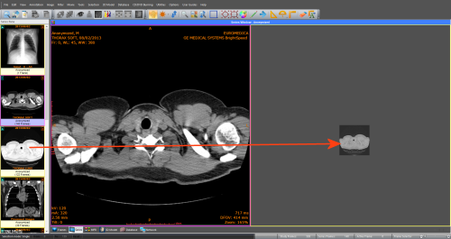 Sante DICOM Viewer Pro | The user interface