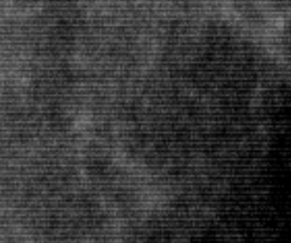 Detail of the noisy image