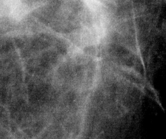 The image with pattern noise